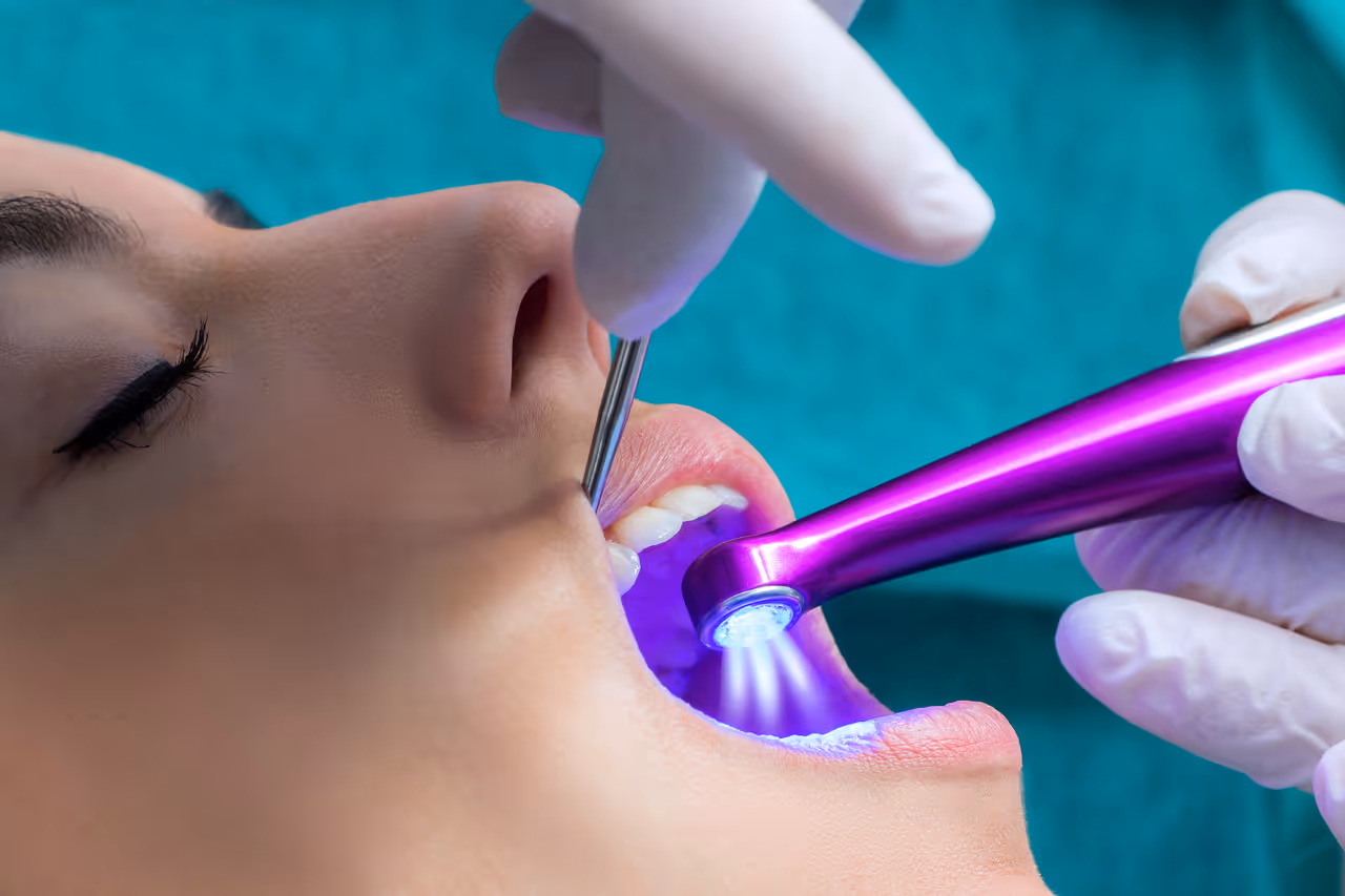 How Dental Sealants Protect Your Teeth